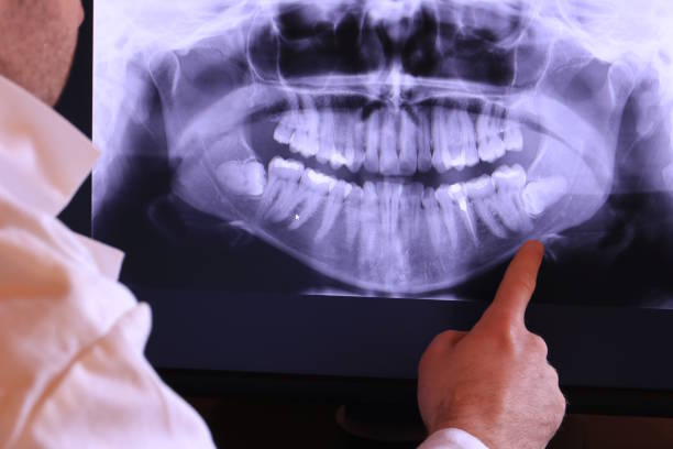 Best Dentist for Tooth Abscess  in Elmwood Place, OH