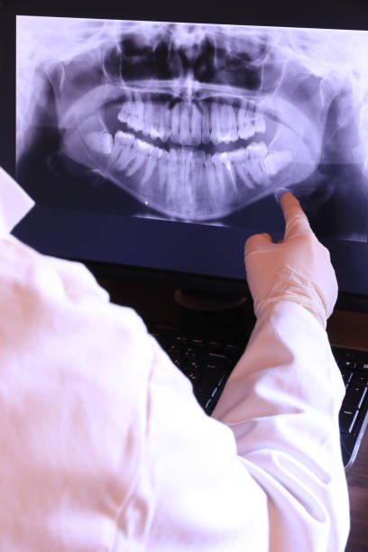 Best Knocked-Out Tooth Emergency  in Elmwood Place, OH