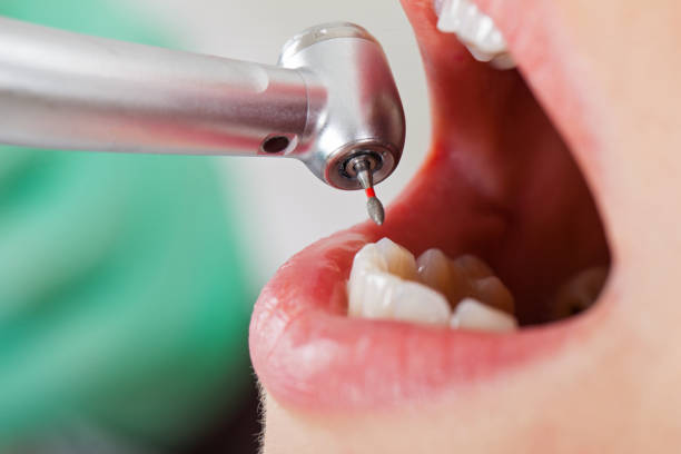 Best Broken Tooth Emergency  in Elmwood Place, OH